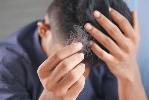 Can Stress Cause Hair Loss? How High Stress Levels Can Make Your Hair Fall Out