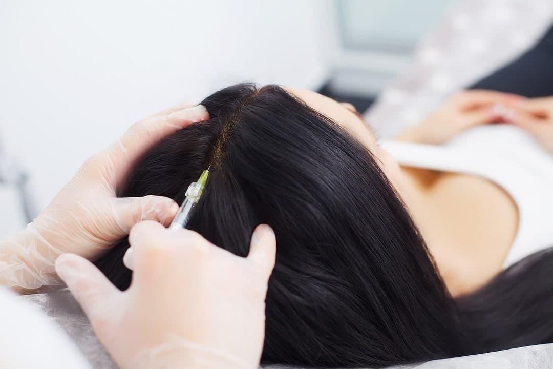 Your Comprehensive Guide to Non-Surgical Hair Transplant Options