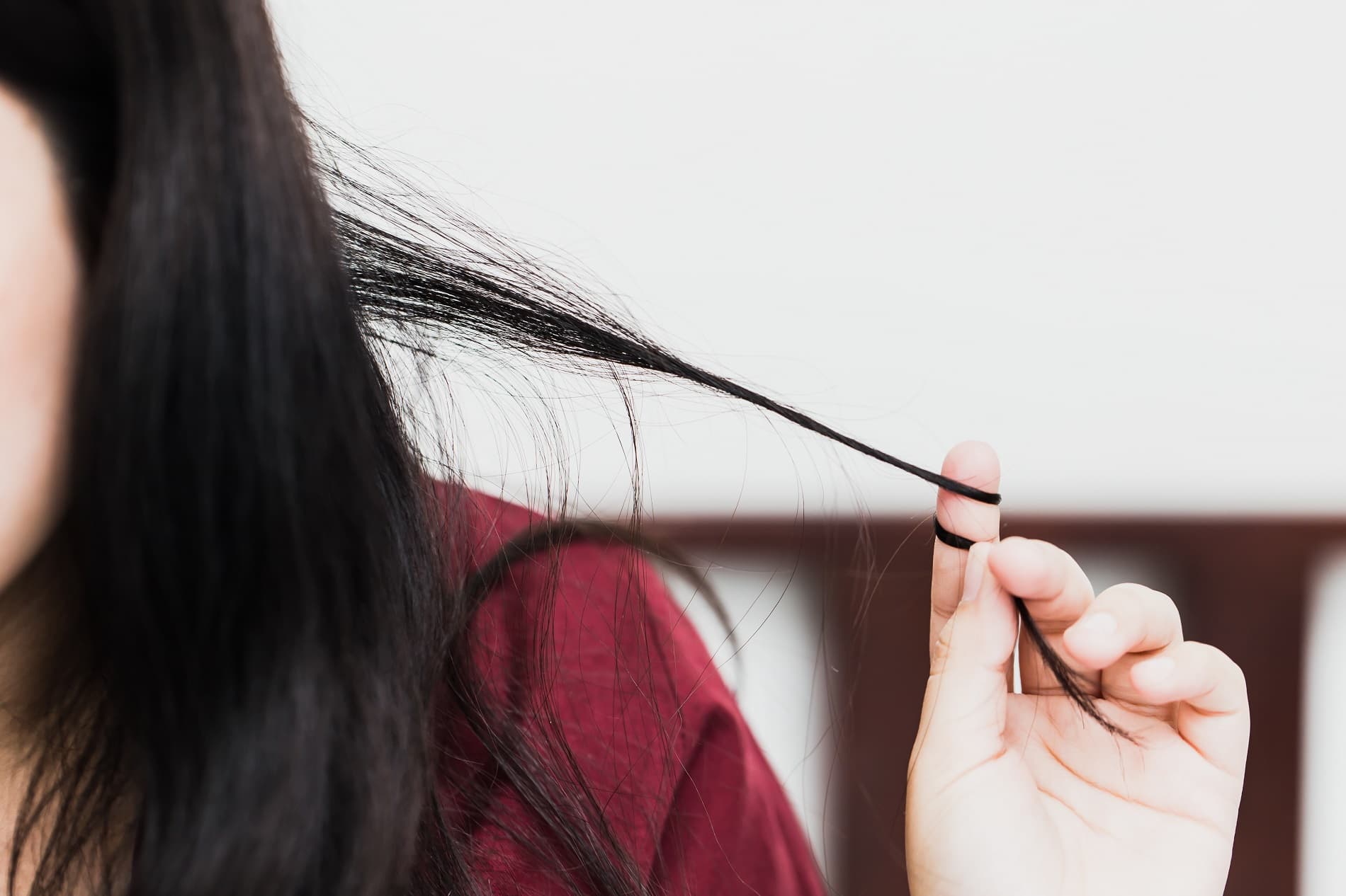 Defining Trichotillomania—A Compulsive Hair-Pulling Disorder