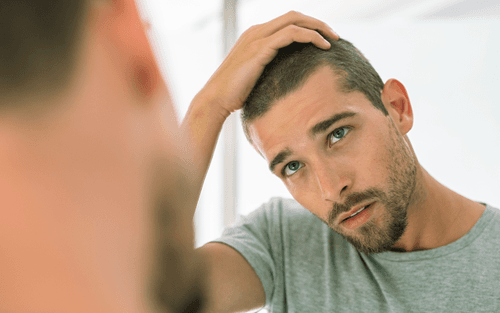 What Is the Hamilton-Norwood Scale?