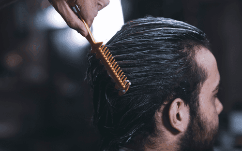 How to Prevent Hair Loss